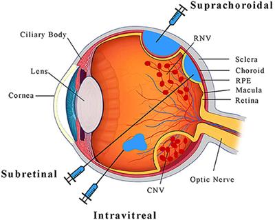 CRISPR Technology for Ocular Angiogenesis